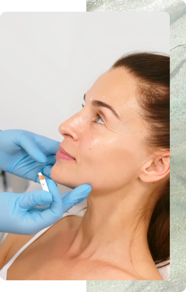 Dermal Filler Procedure: Step by Step Banner