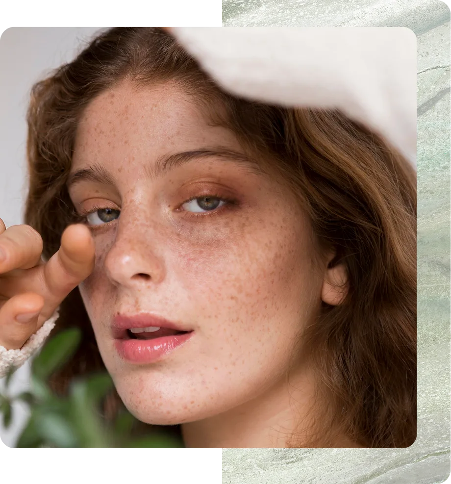 Melasma Solutions in Boston, MA Banner