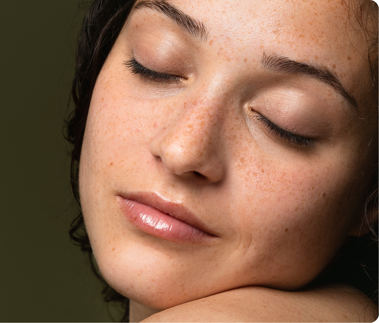 Melasma Treatment Boston, MA Banner