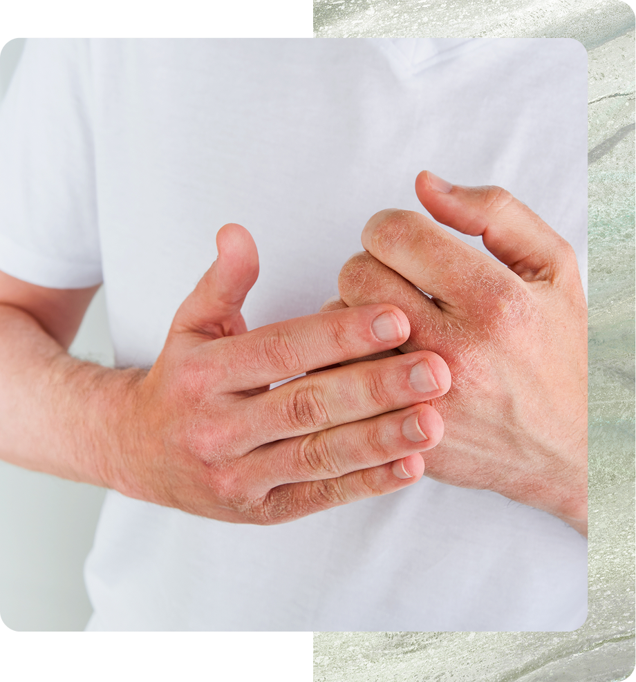 Eczema Specialist in Boston, MA Banner