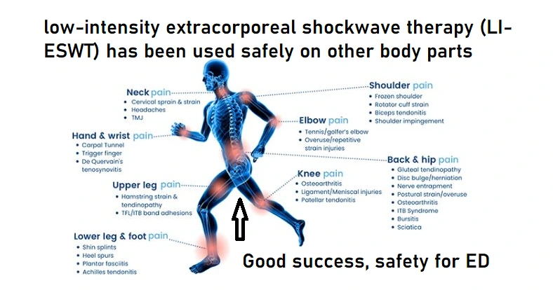Blue anatomical figure with labeled pain conditions treated by low-intensity extracorporeal shockwave therapy: neck, shoulder, elbow, hand, wrist, upper leg, lower leg, knee, and back pain, with text stating Good success, safety for ED