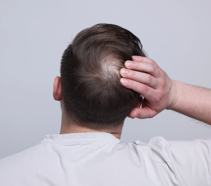 Hair Restoration Treatment Boston, MA Banner