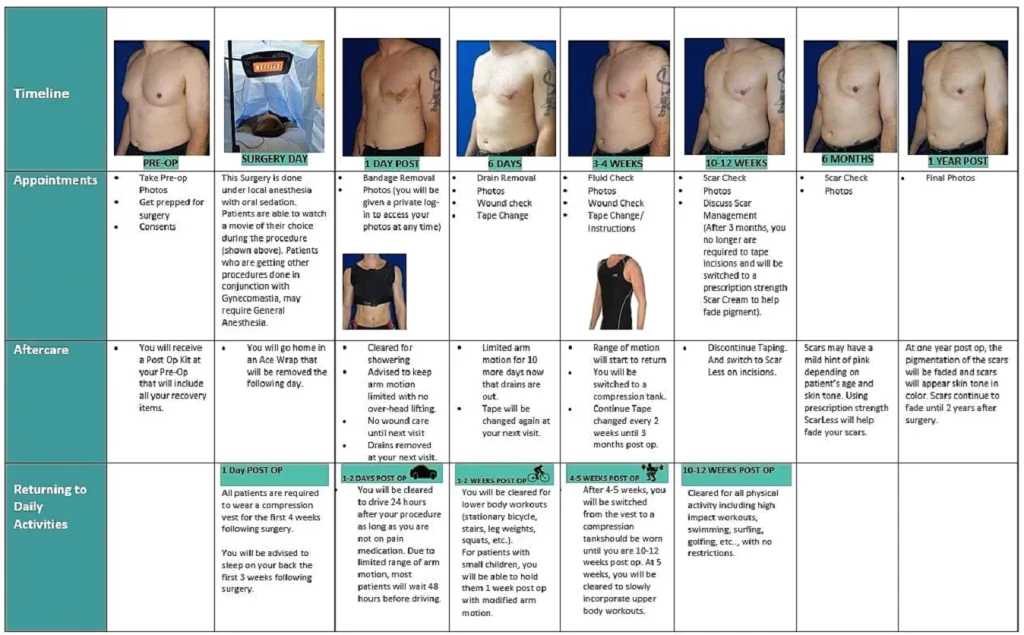 Recovery timeline chart showing patient photos and care instructions from pre-op through one year post-surgery