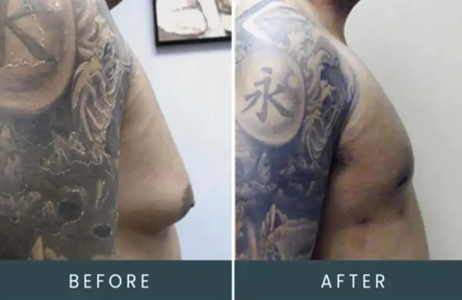 Before and after full-sleeve tattoo showing enhanced clarity and color vibrancy