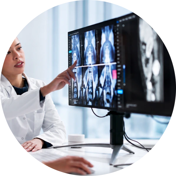 Healthcare provider pointing to brain imaging scans on a medical monitor