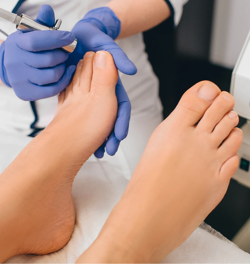 Podiatrist in blue gloves using laser treatment device on patient's foot