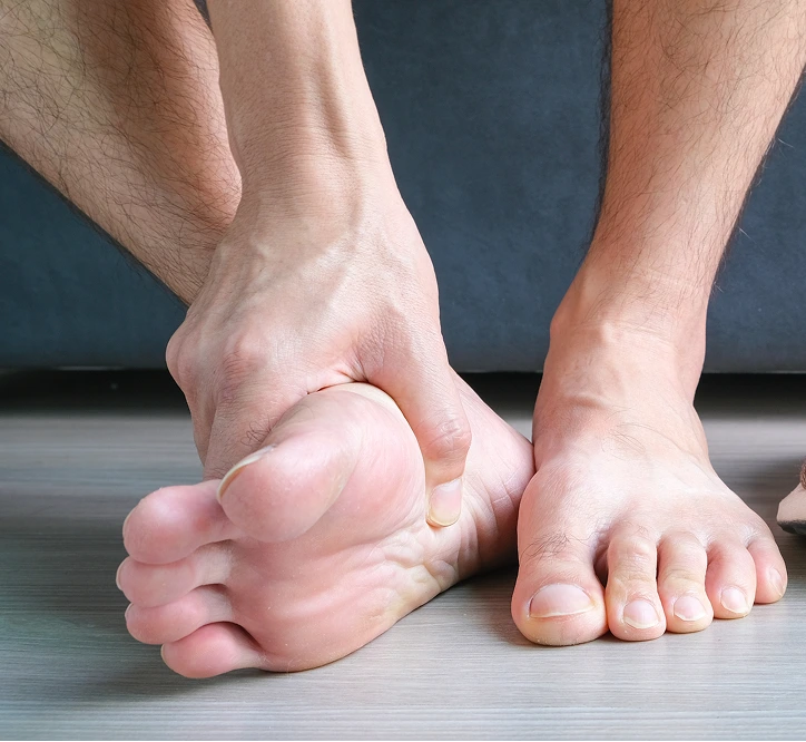 Person with hand cupping sole of foot showing red inflamed area on arch