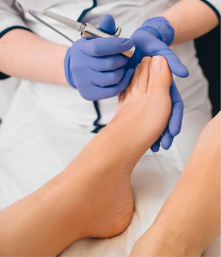 Podiatrist in blue gloves examining patient's foot with diagnostic instrument