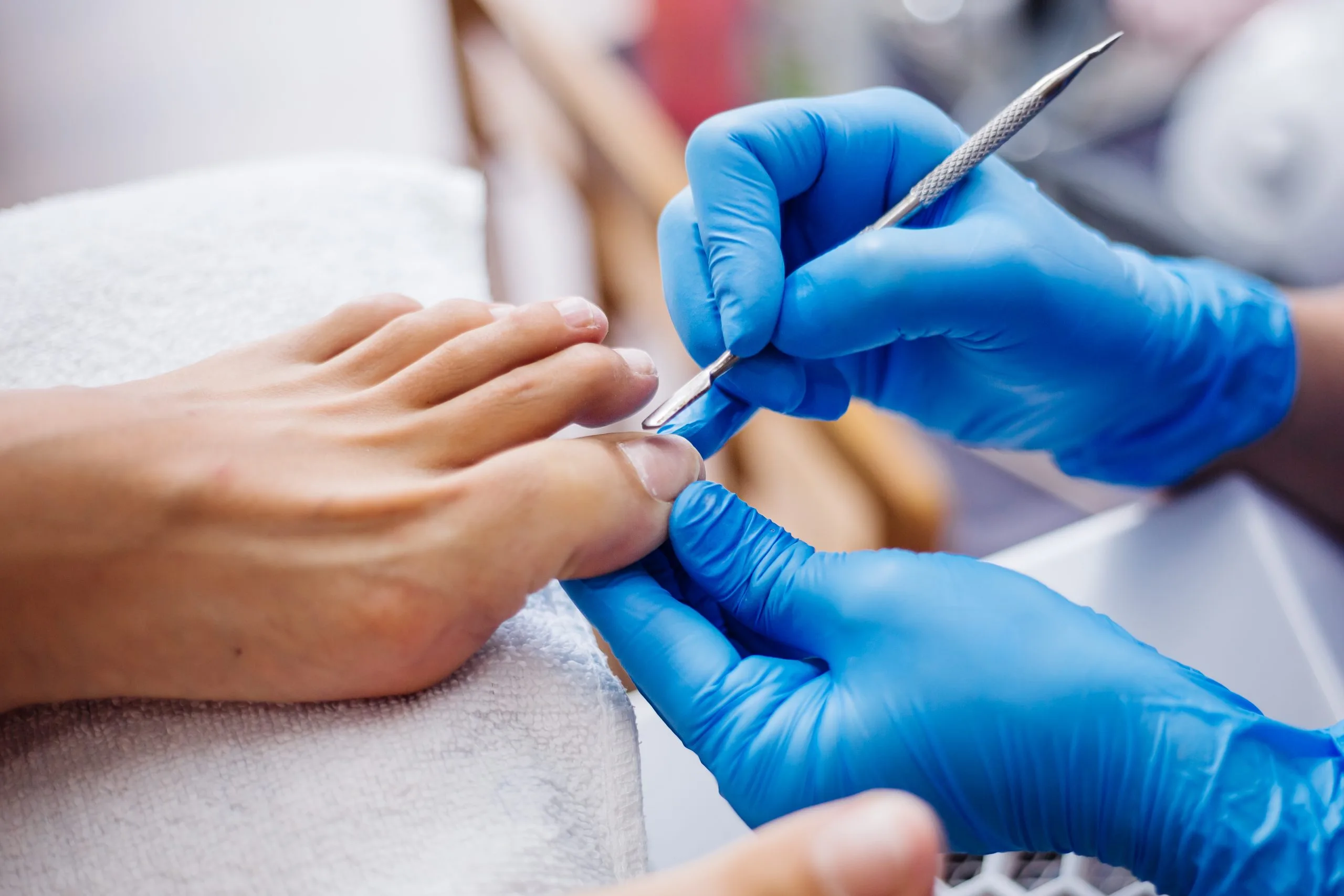 How to Prevent Toenail Fungus from Returning After Treatment Banner