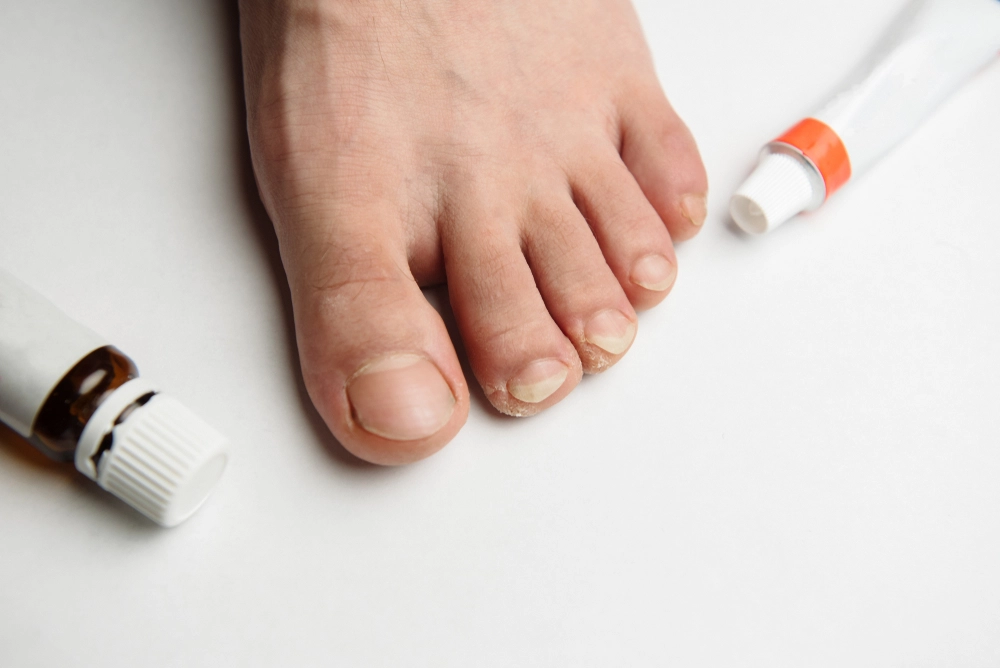 Foot next to topical medicine bottles with orange and brown caps