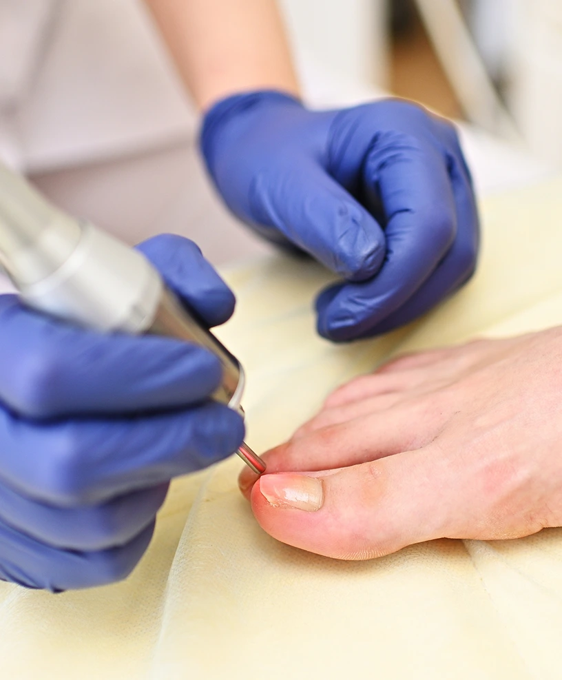 Healthcare provider wearing blue gloves using a tool to examine a patient's foot