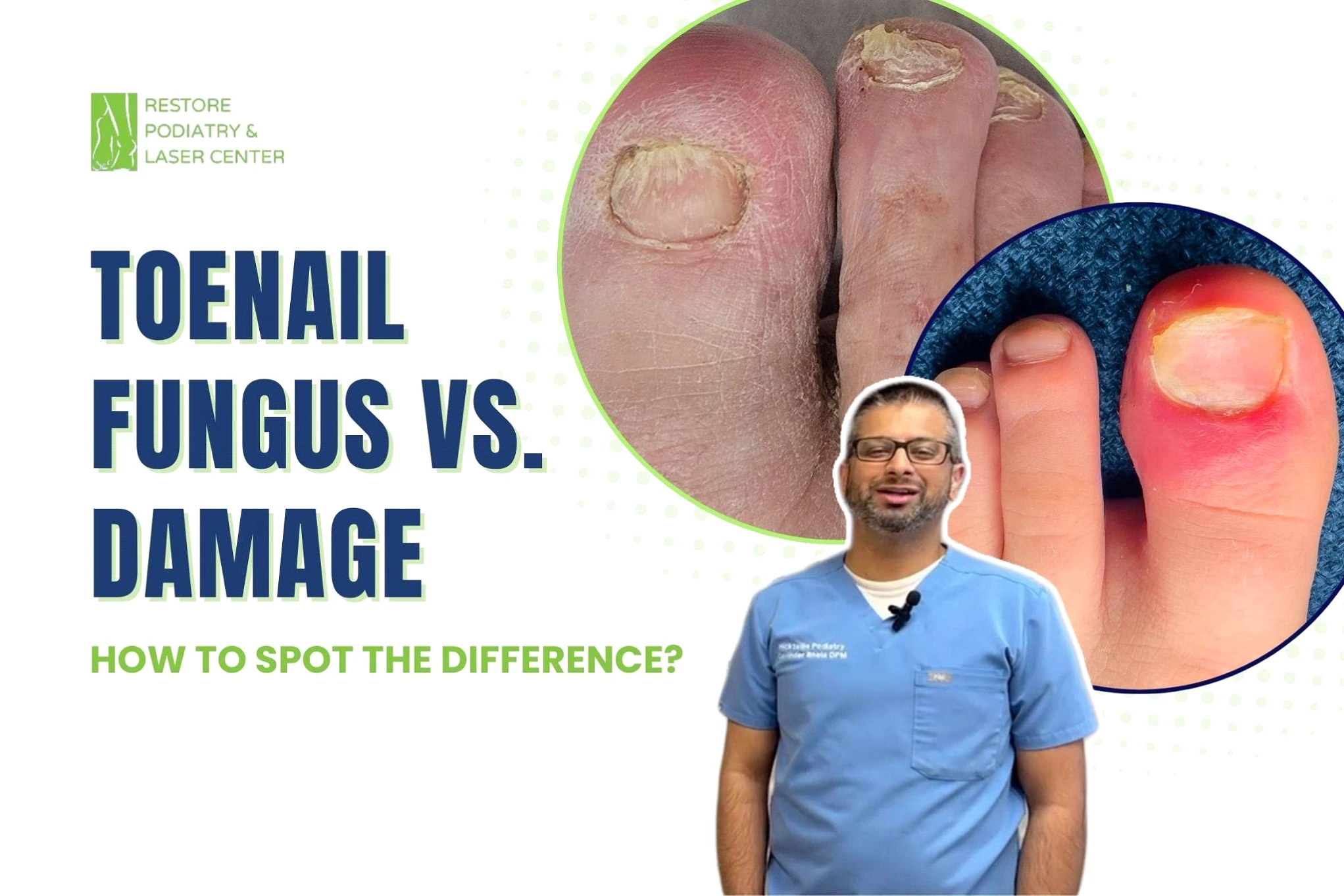 Podiatrist in blue scrubs explaining toenail fungus versus damage, with close-up images of infected toenails displayed