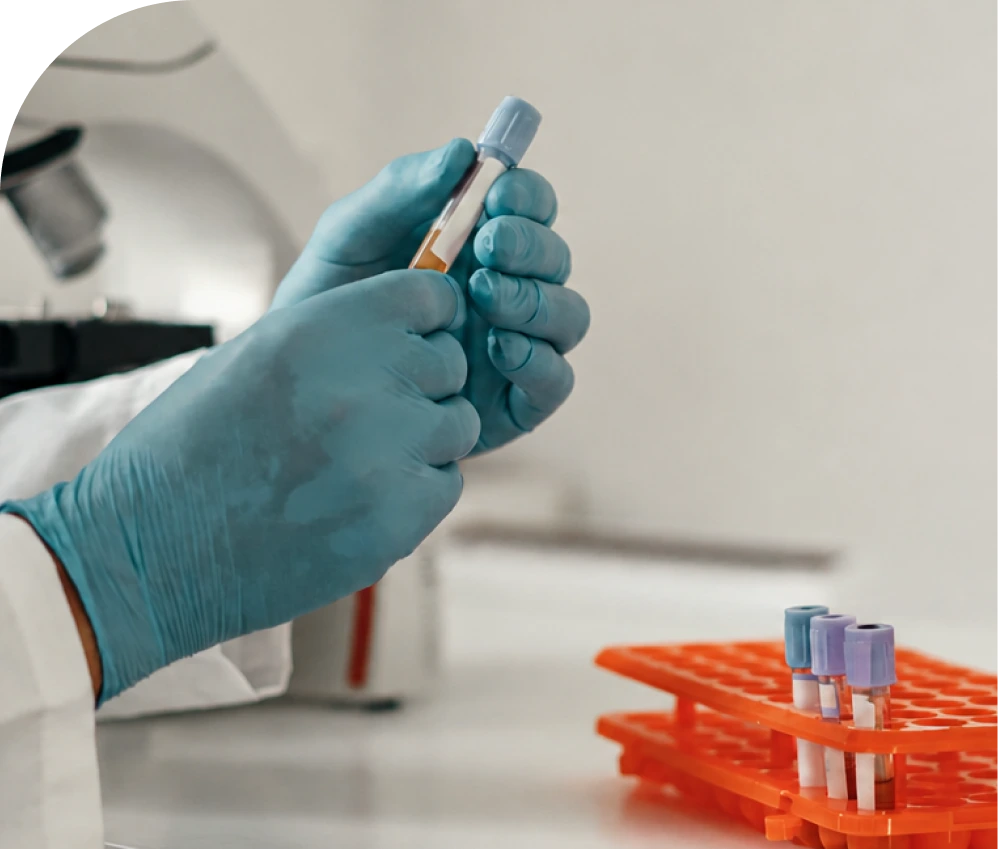 Lab technician handling blood test tubes for lab testing