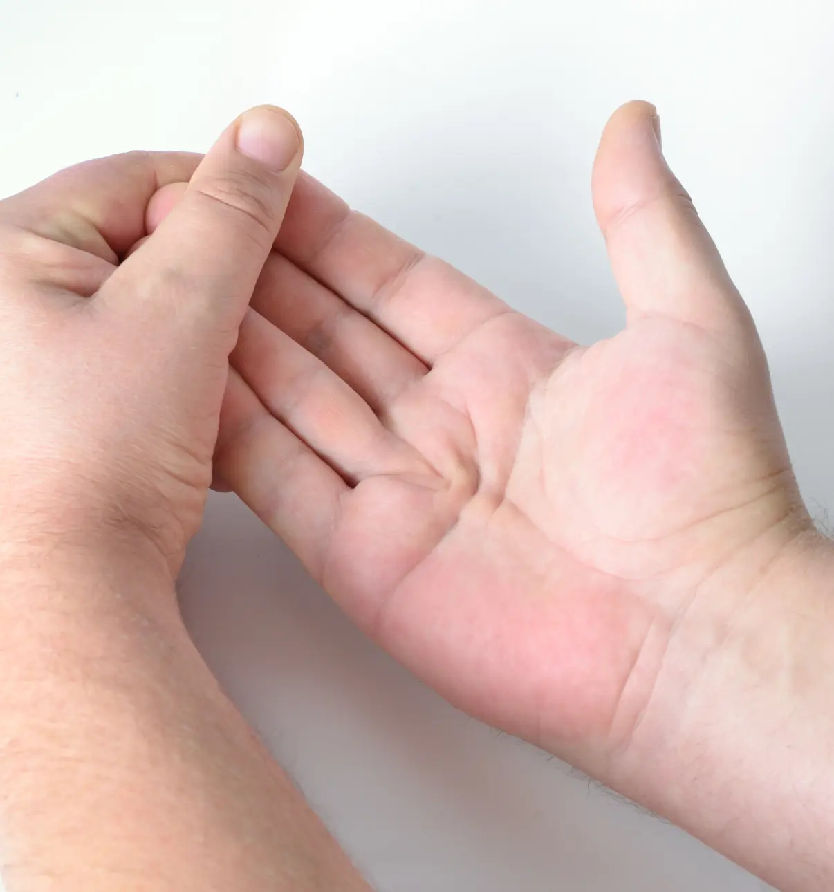 Dupuytren’s Contracture Treatment Banner