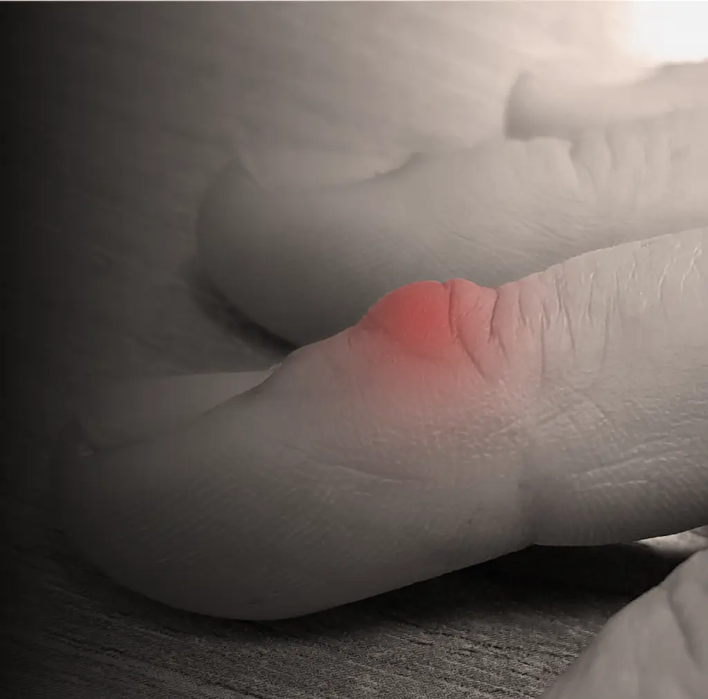Finger Masses Treatment Banner