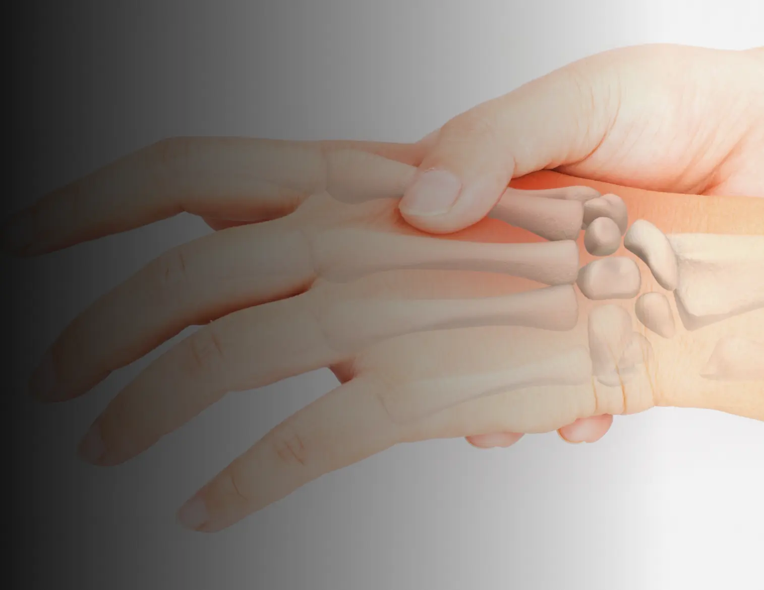 Metacarpal Fractures Banner