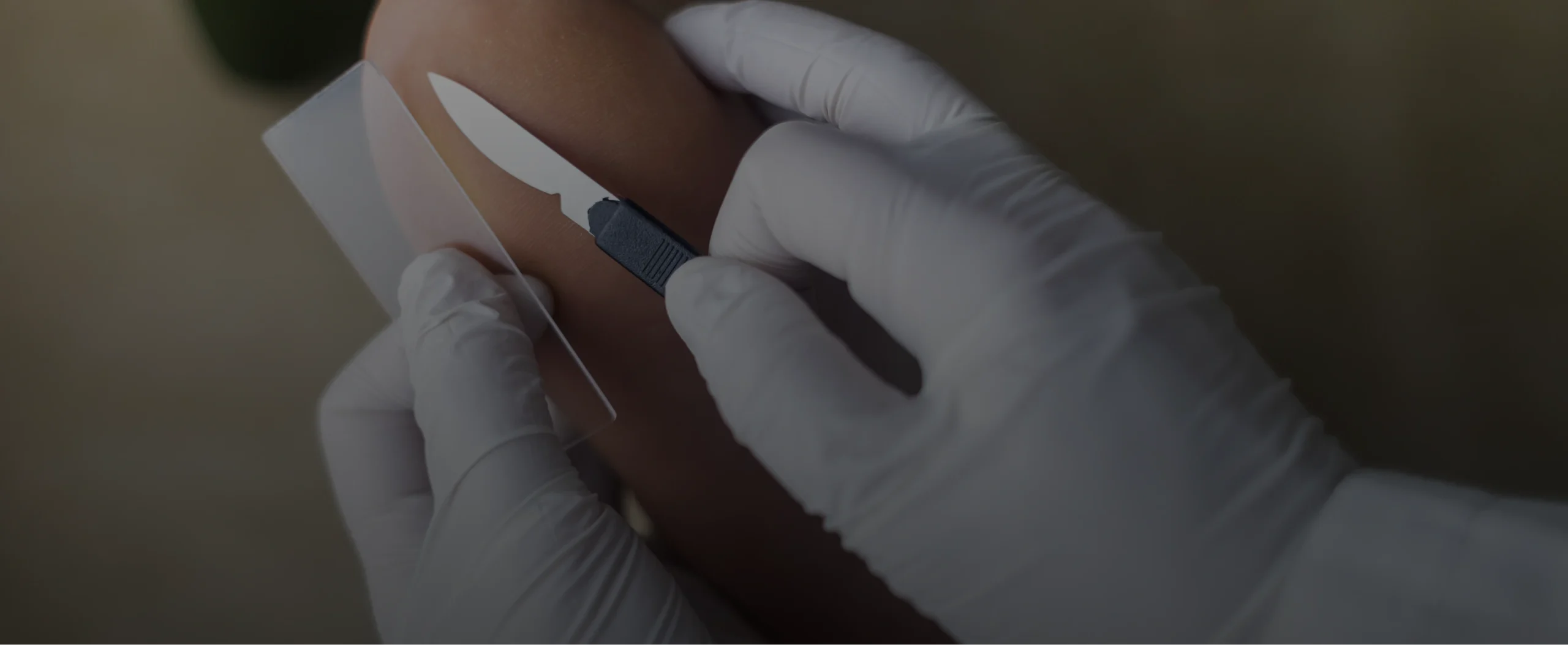 Biopsies in Miami, FL BG