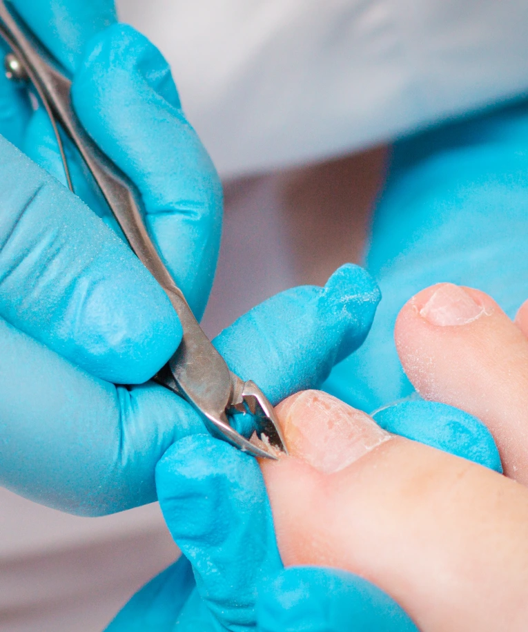 Ingrown Nail Care in Miami, FL Banner