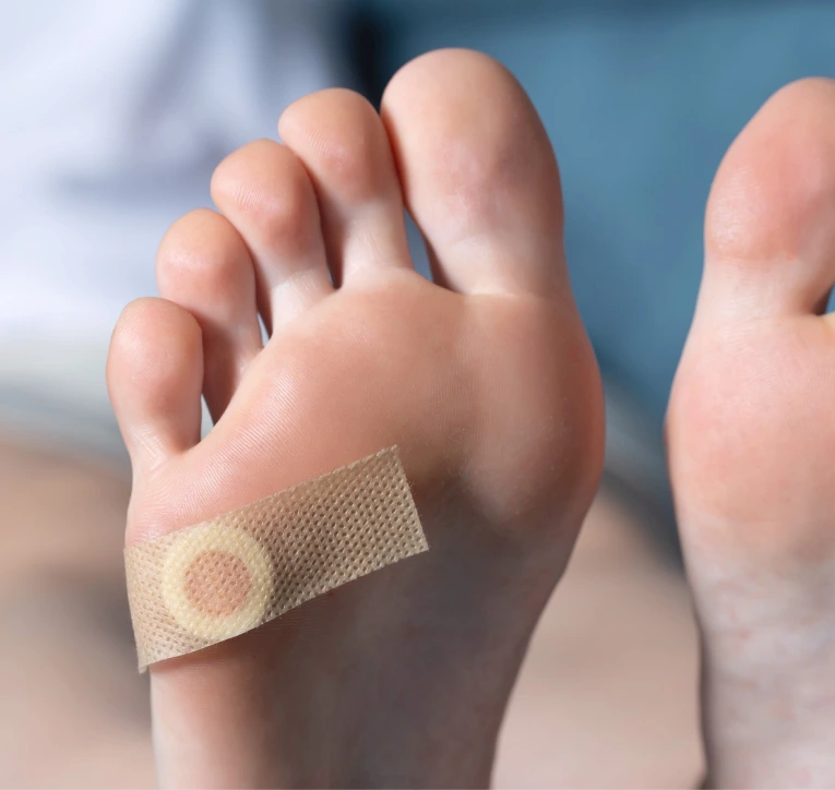 Corn and Callus Removal in Miami, FL Banner