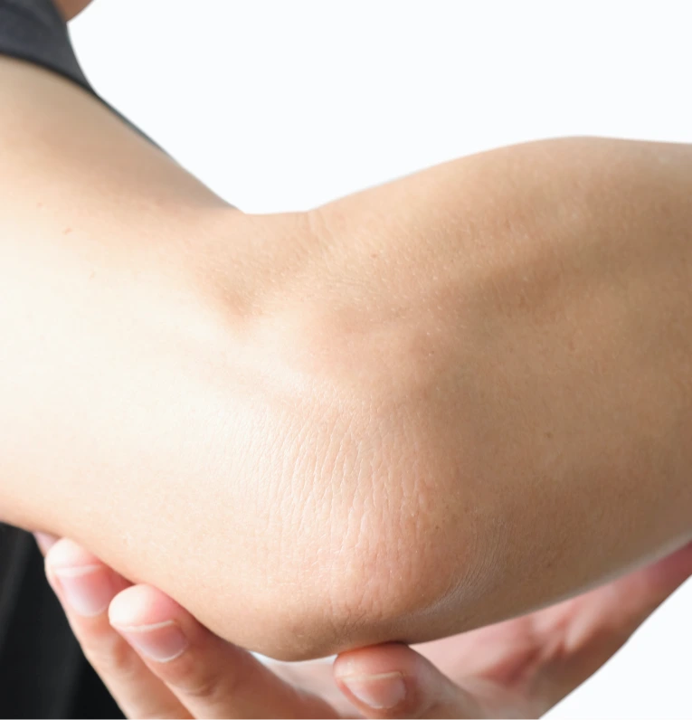Miami Cubital Tunnel Syndrome Diagnosis and Treatment Banner
