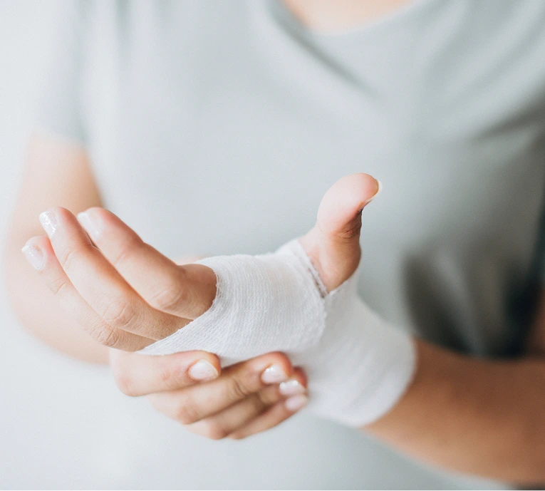 Person displaying a hand wrapped in white gauze bandaging for fracture support