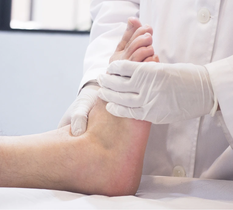 Healthcare provider in white coat examining a patient's foot wound with gloved hands