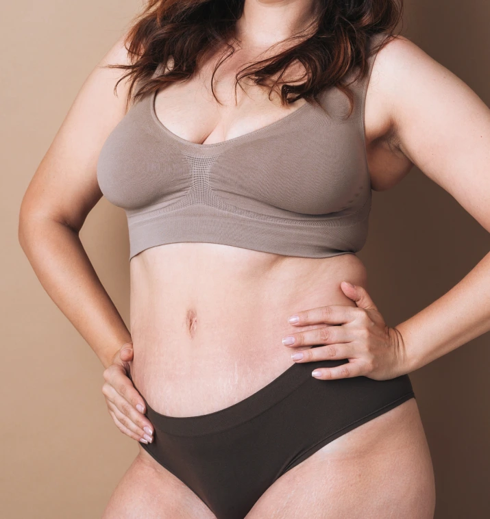 Recovery After Large-Volume Liposuction