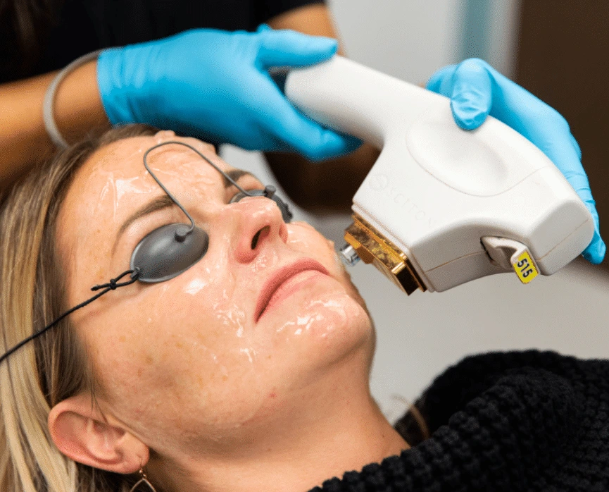 Clinician in blue gloves applying broadband light therapy device to patient's face wearing protective eyewear