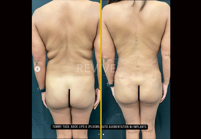 30b