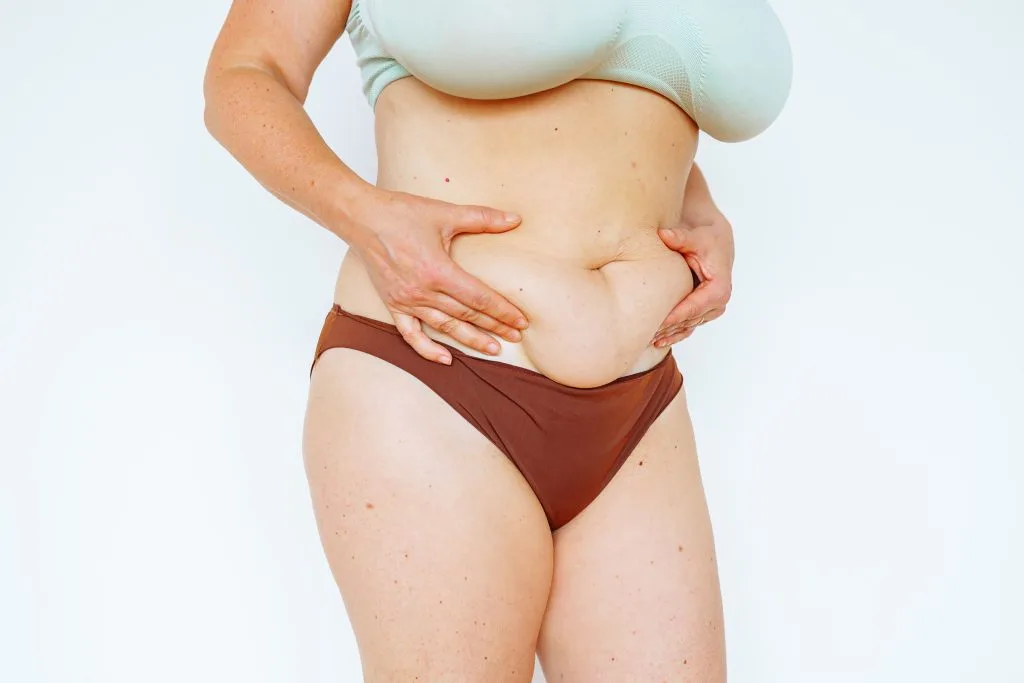 Mommy Makeover After Weight Loss: How It Helps Restore Your Shape banner