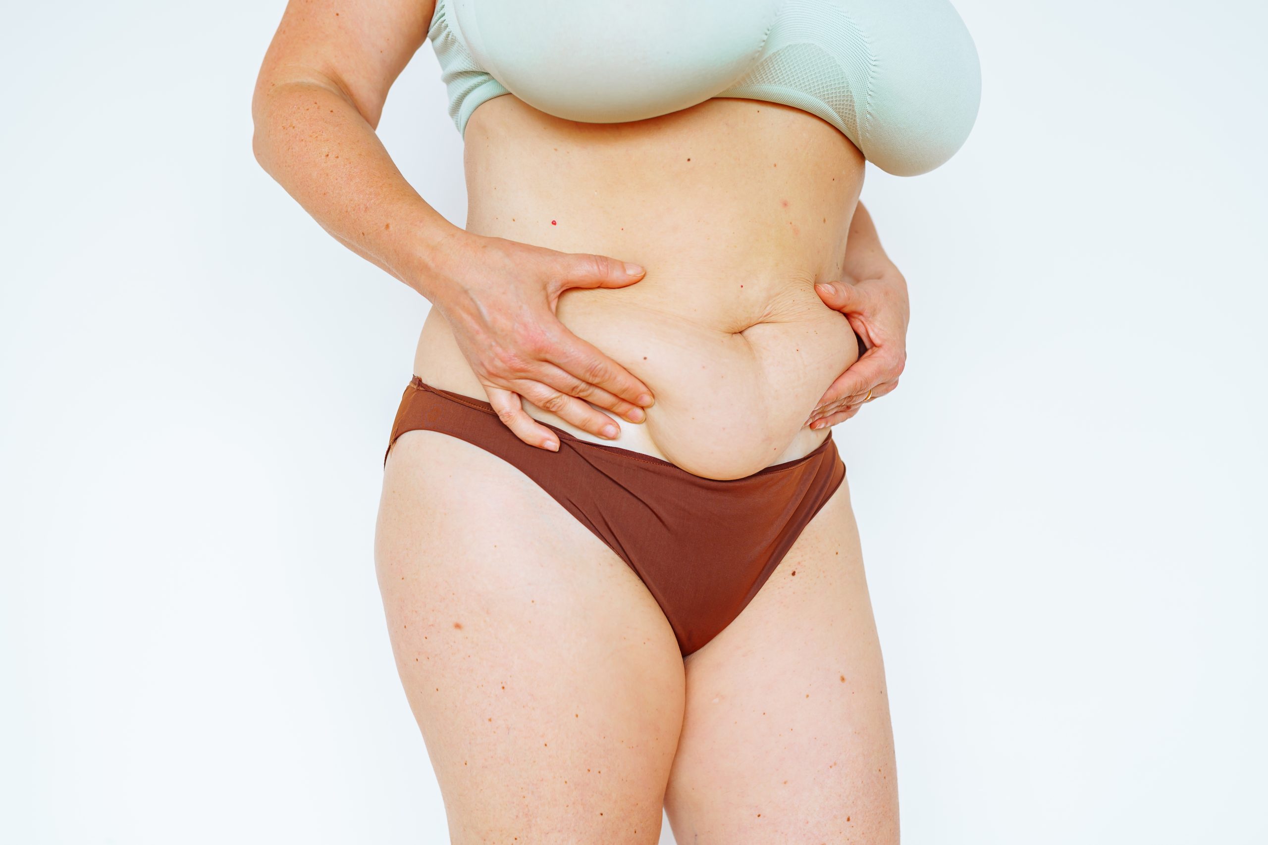 Mommy Makeover After Weight Loss: How It Helps Restore Your Shape banner