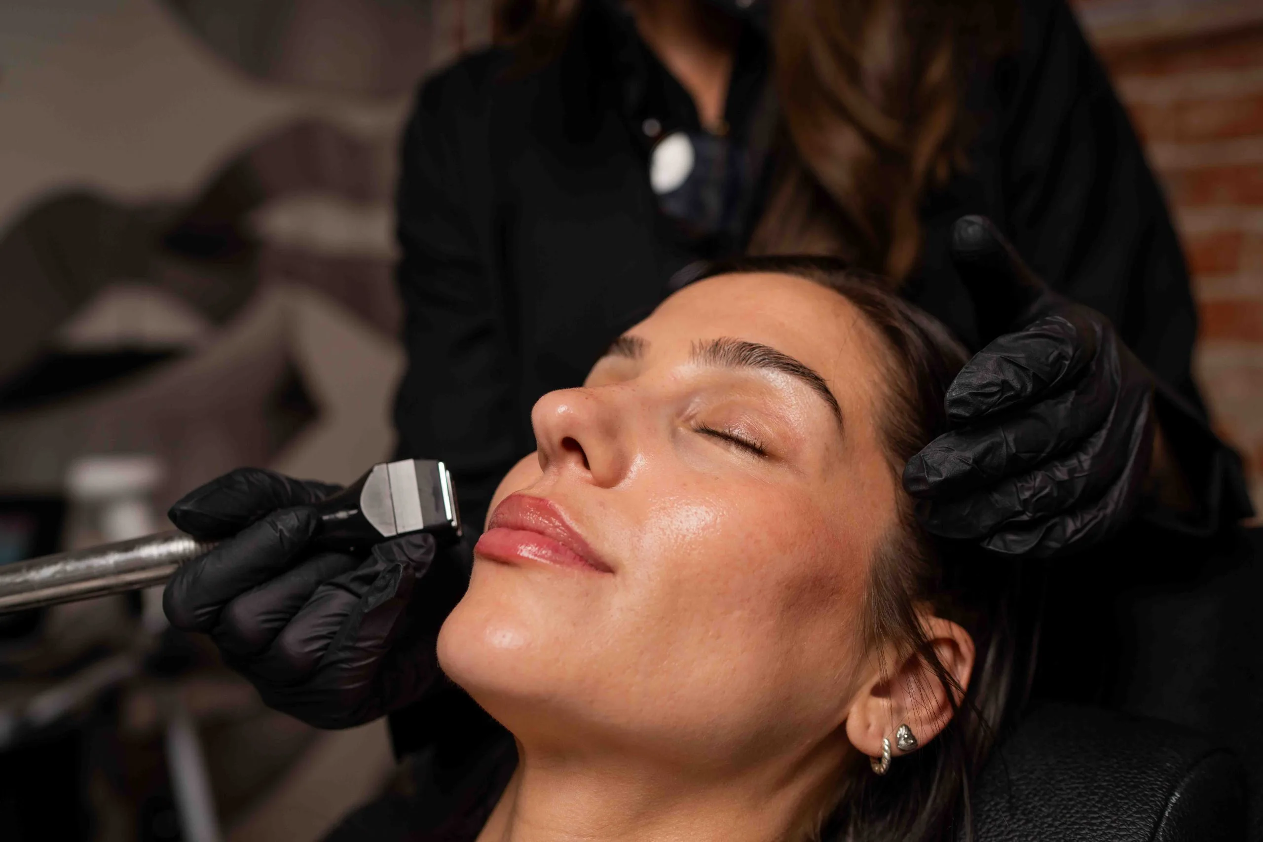 Forma Treatment at Rewind Aesthetics in Culver City