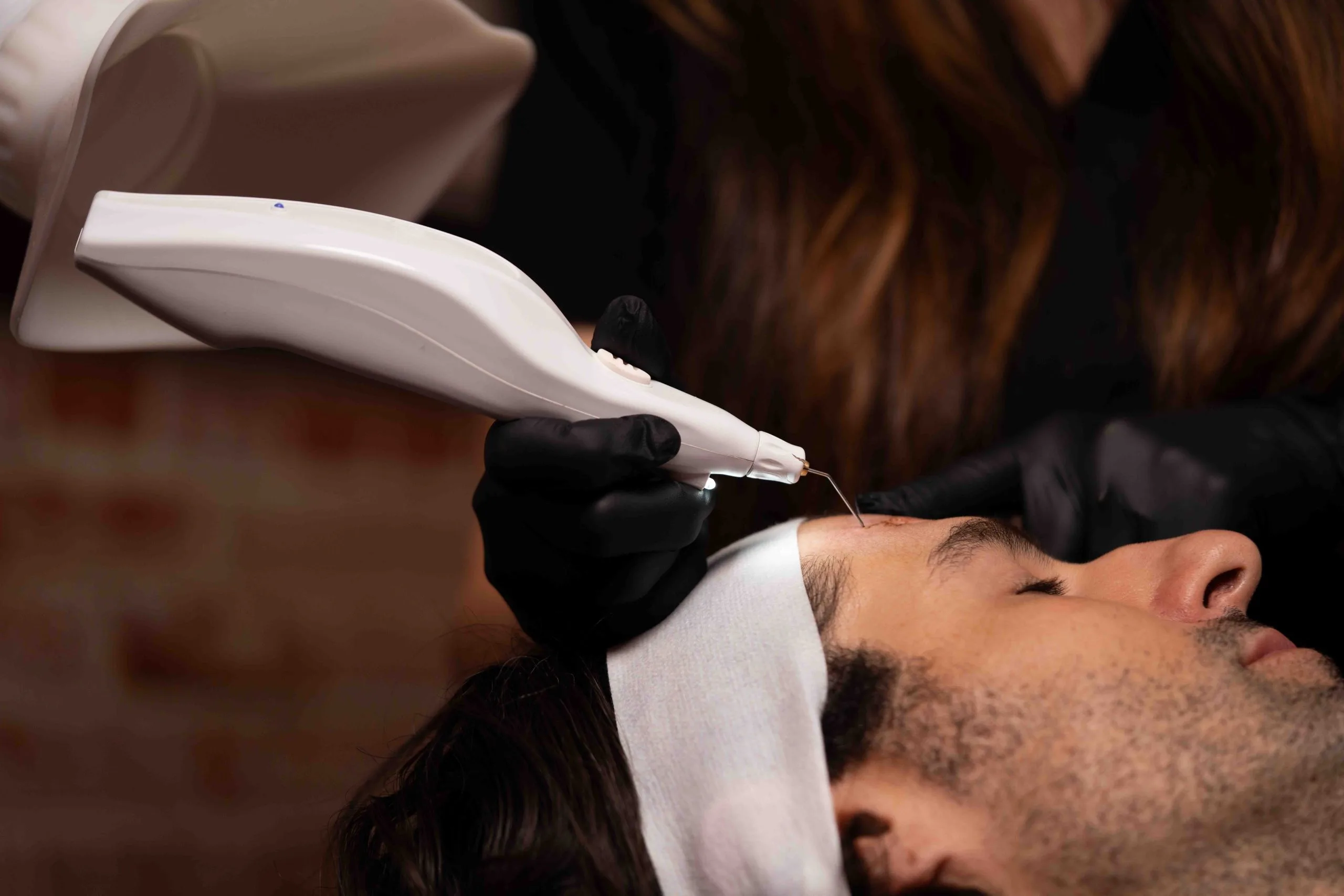 PLEXR Plasma Treatment at Rewind Aesthetics in Culver City