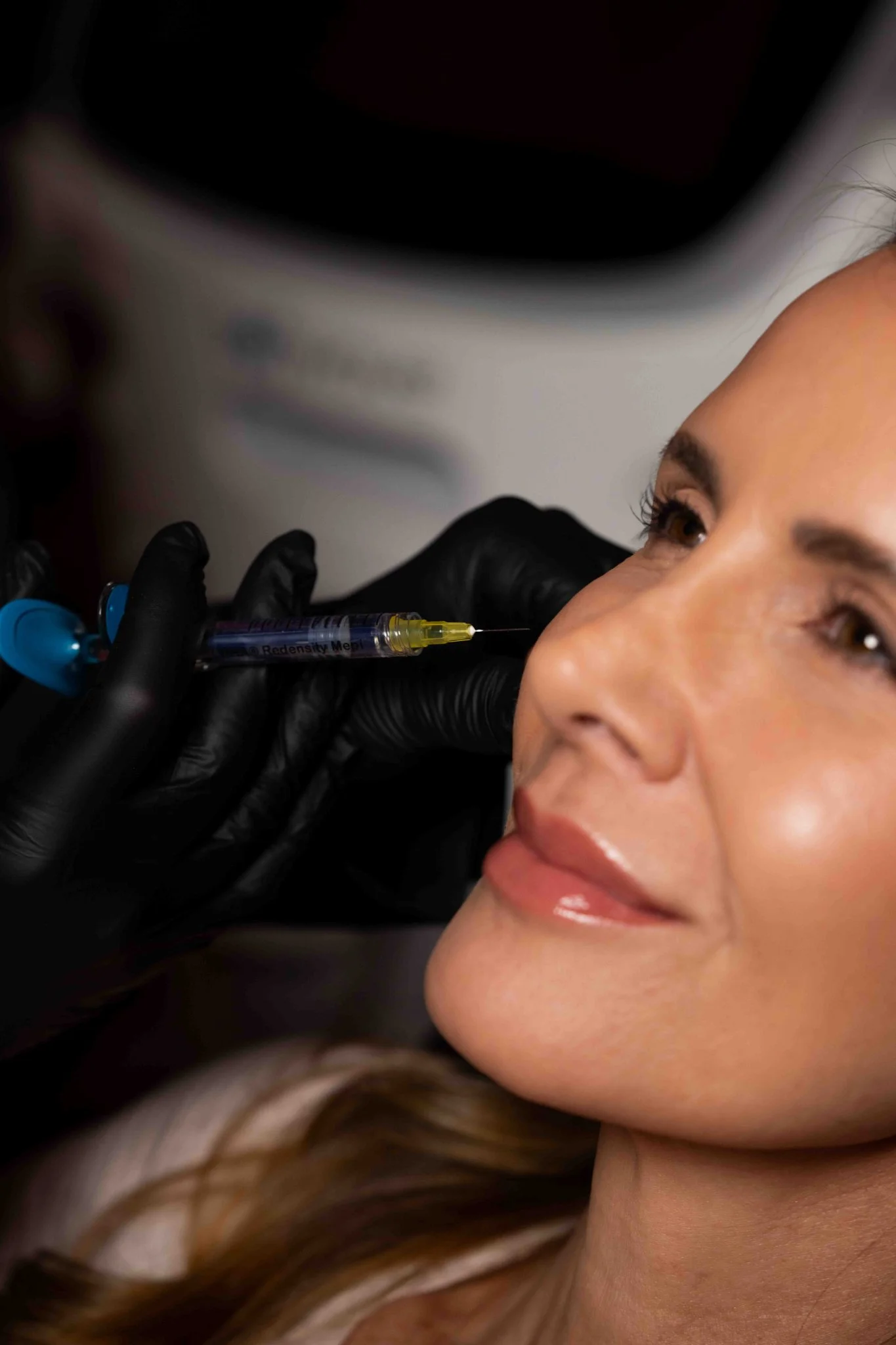 Dermal Fillers at Rewind Aesthetics