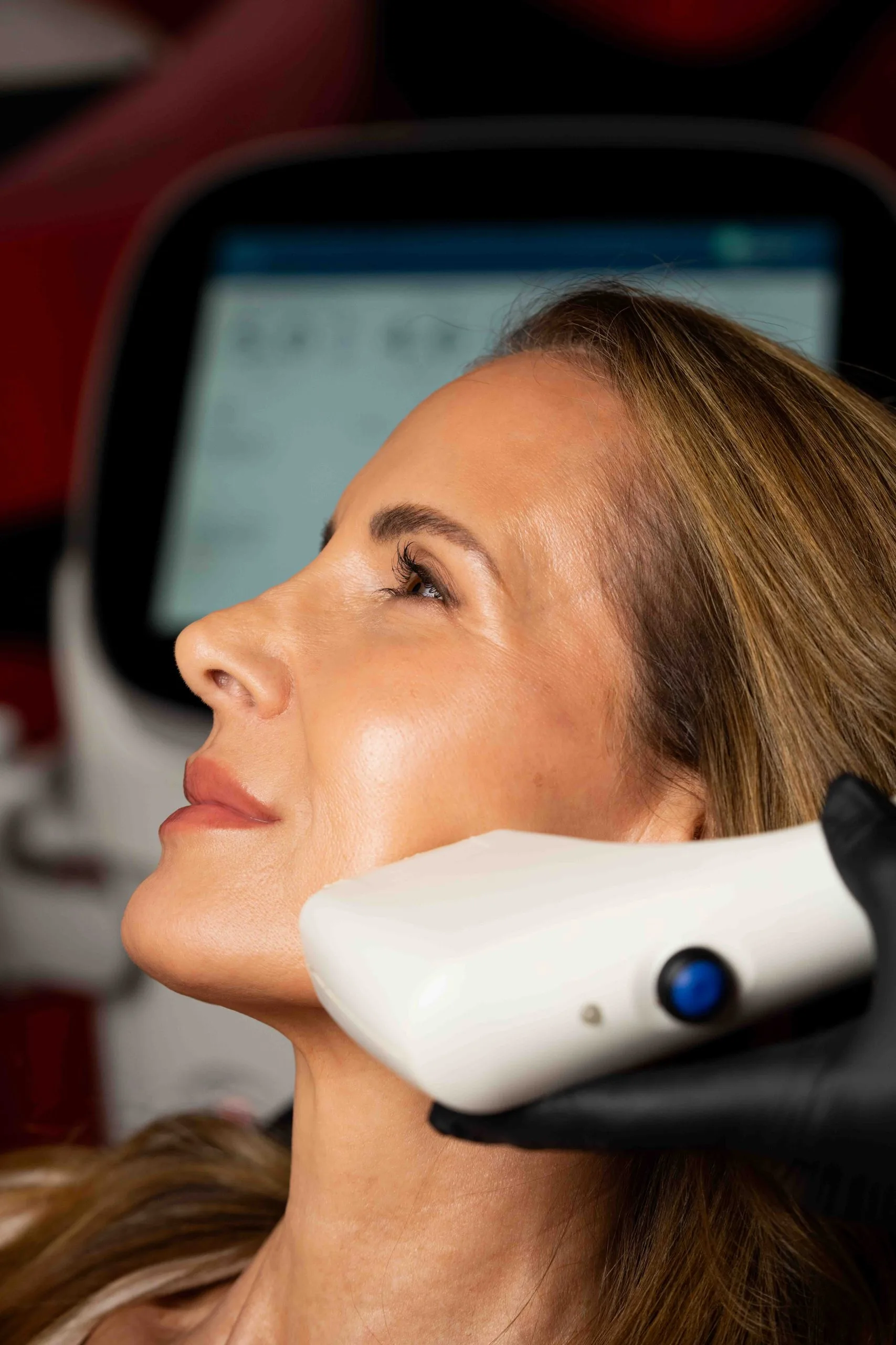 Sofwave™ at Rewind Aesthetics