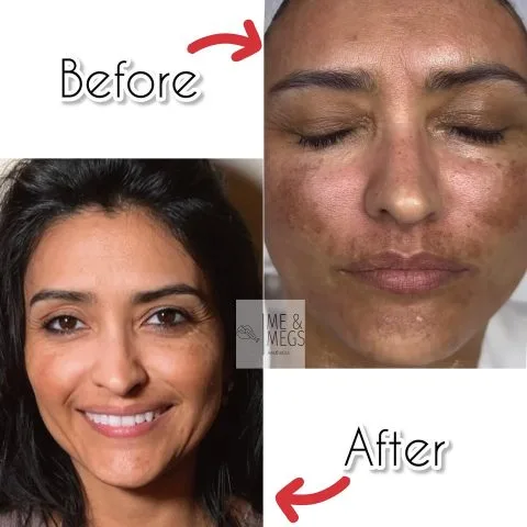 Morpheus - Case 1 before and after