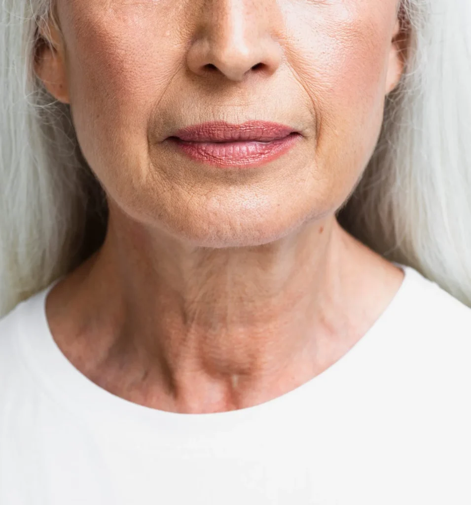 What Is Neck Lift? Banner