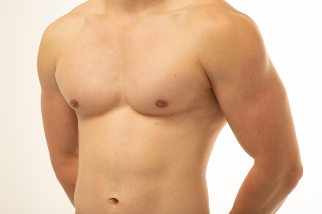 Gynecomastia vs Chest Fat: How to Tell the Difference and What to Do About It Banner