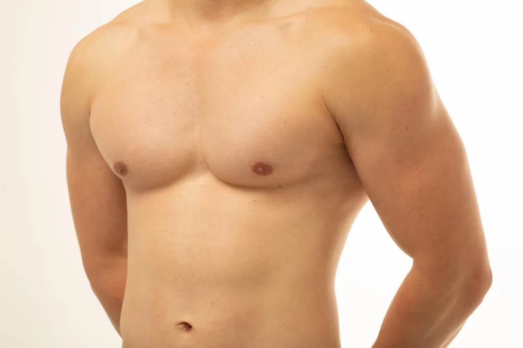 Gynecomastia vs Chest Fat: How to Tell the Difference and What to Do About It Banner