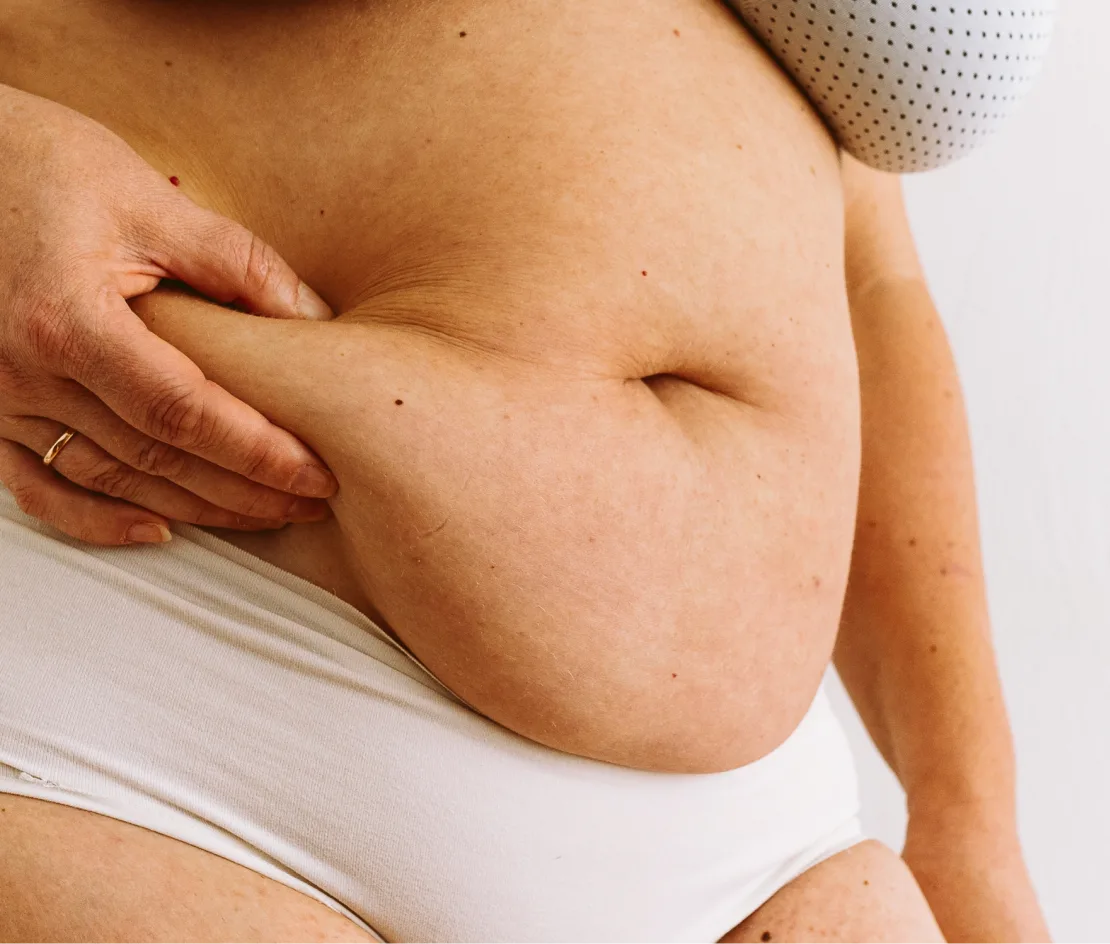 Panniculectomy surgery in Tucson, AZ Banner