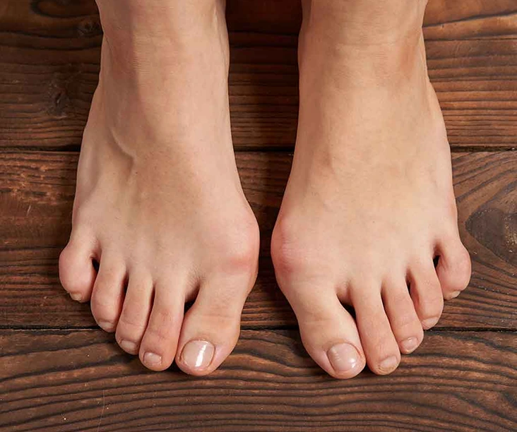 Healthy feet viewed from above on a wooden surface