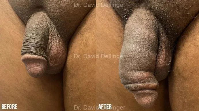 Before and after comparison labeled with Dr. David Dellinger's name