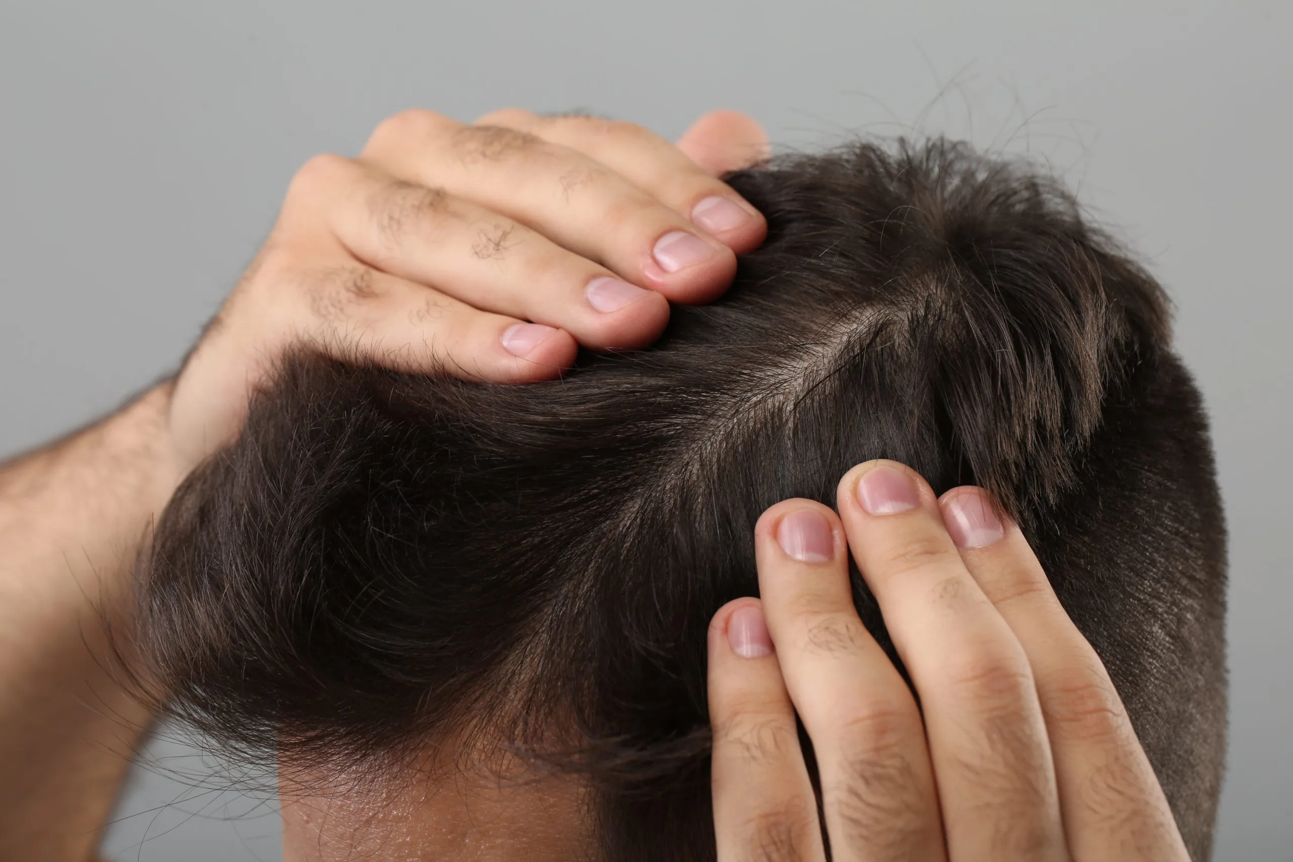 Man's hands examining his hair for signs of hair loss or thinning