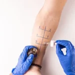 Allergy Testing