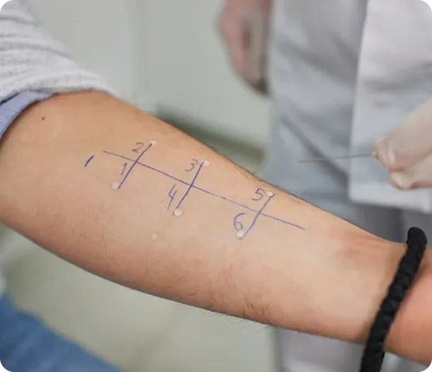 Allergy Testing Services in Houston, TX Banner