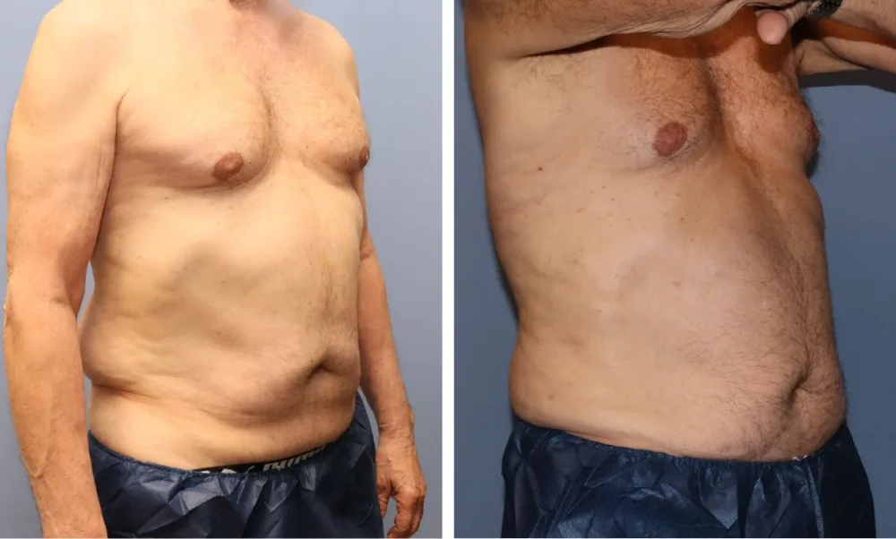 Case_ LIPO-001 (2)