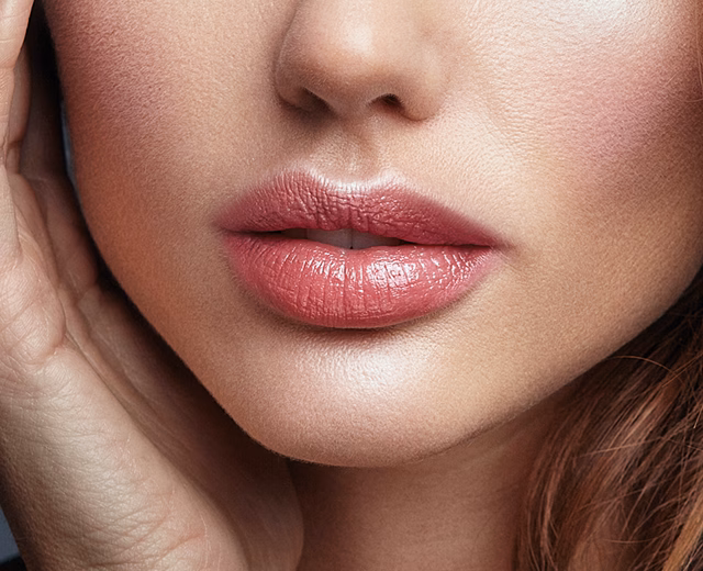 Lip Fillers