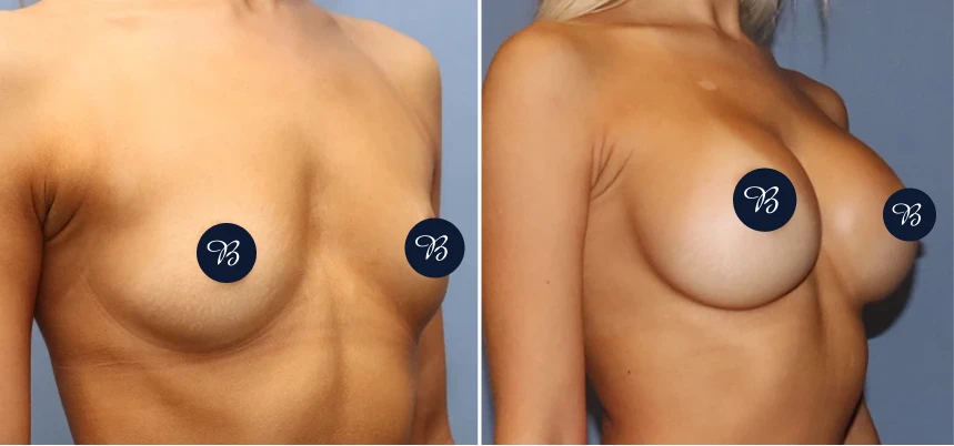 Case 36 BA (1)