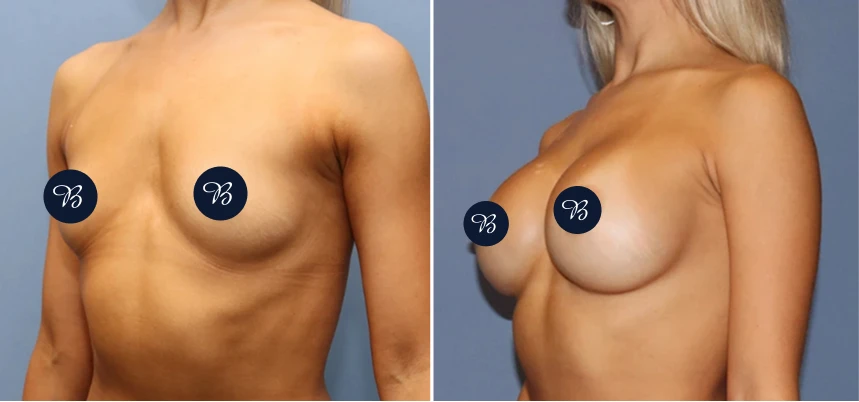 Case 36 BA (2)