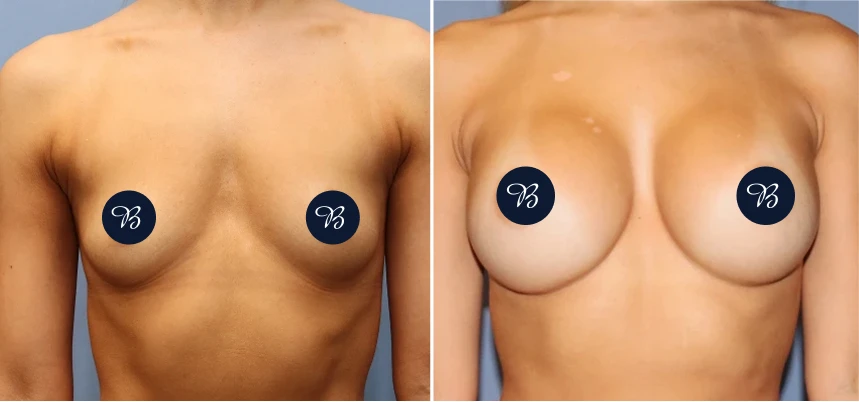Case 36 BA (4)